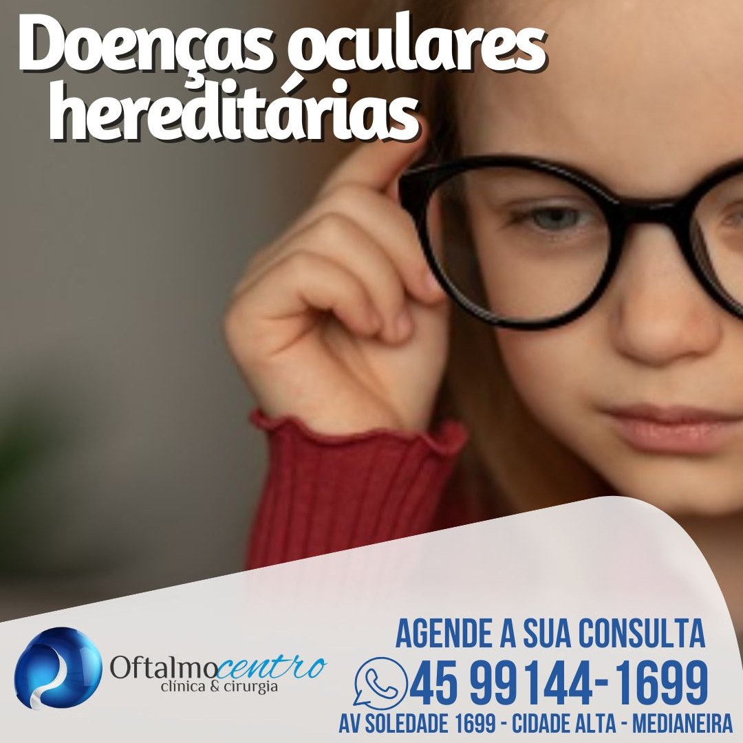 Doenças oculares-podem ser hereditárias