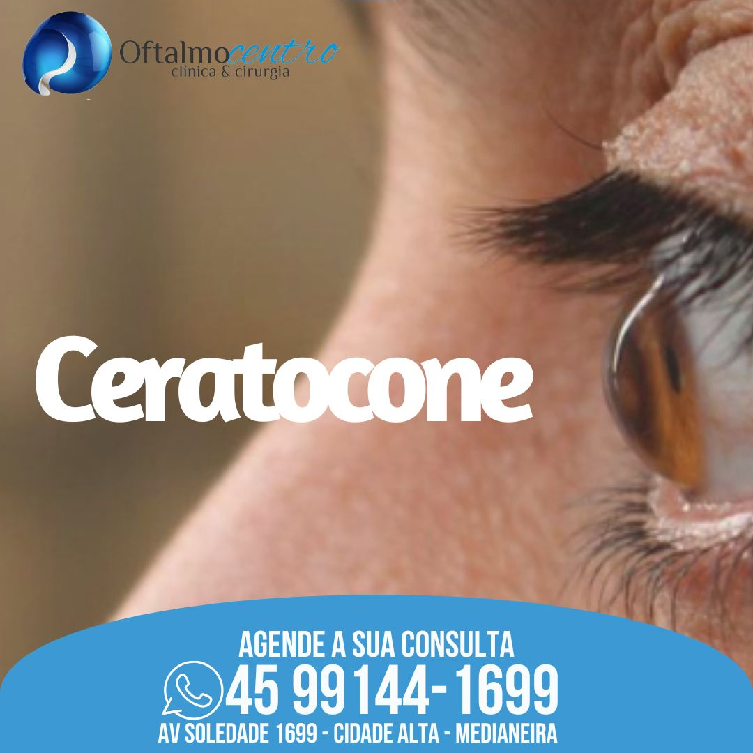 Ceratocone-Saiba mais