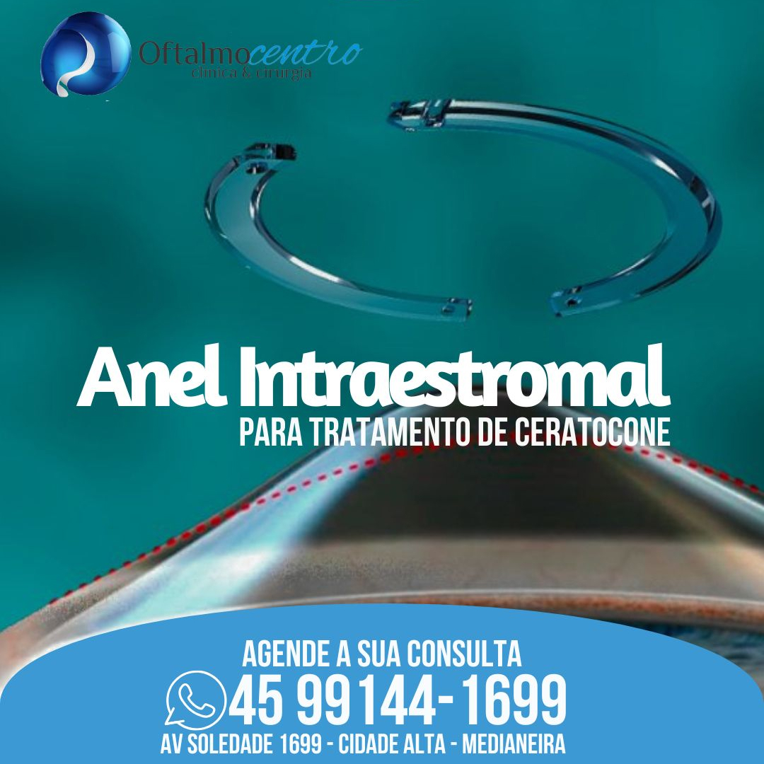 Anel intraestromal-para tratar ceratocone