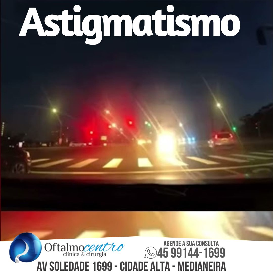 Astigmatismo-tratamentos que podem ser feitos